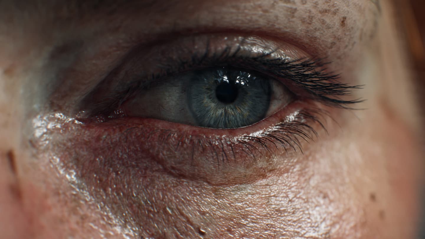 Five Home Remedies that do Wonders to Cure Dry Eyes